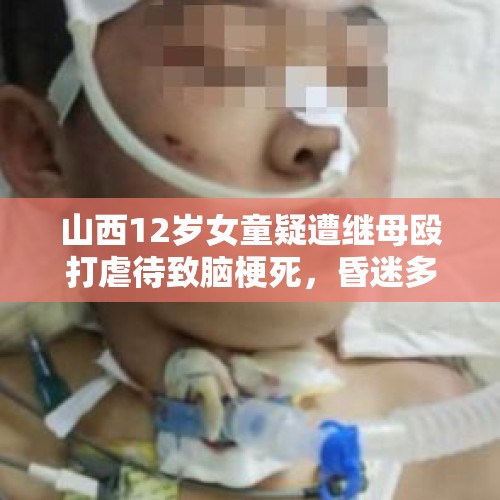 山西12岁女童疑遭继母殴打虐待致脑梗死，昏迷多日，怎么回事吗？，幼童遭虐待脑死亡