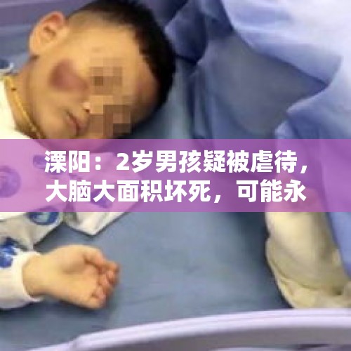 溧阳：2岁男孩疑被虐待，大脑大面积坏死，可能永远无法醒来, 你怎么看？，4岁女童被虐案后续：ICU抢救未脱险，生父系跆拳道黑带也参与殴打，如何评价？