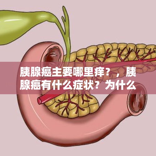 胰腺癌主要哪里痒？，胰腺癌有什么症状？为什么发病率这么高？