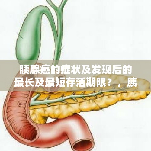 胰腺癌的症状及发现后的最长及最短存活期限？，胰腺癌的症状有哪些？