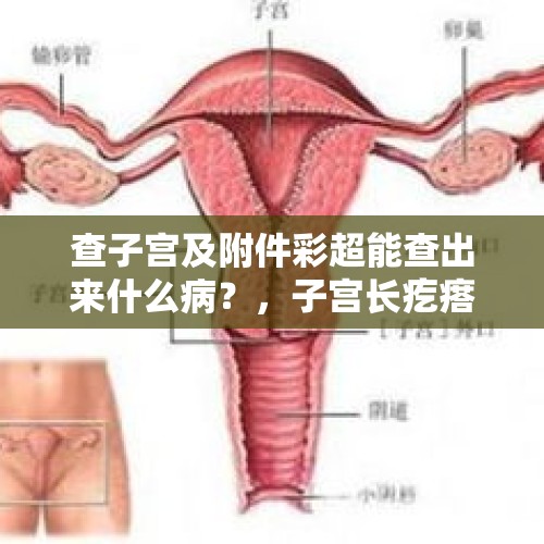 查子宫及附件彩超能查出来什么病？，子宫长疙瘩是什么病？