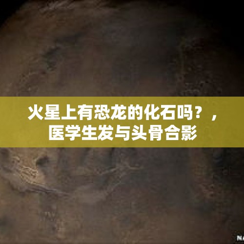 火星上有恐龙的化石吗？，医学生发与头骨合影