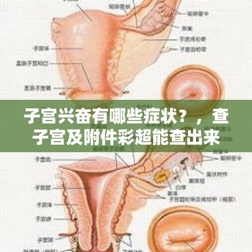 子宫兴奋有哪些症状？，查子宫及附件彩超能查出来什么病？