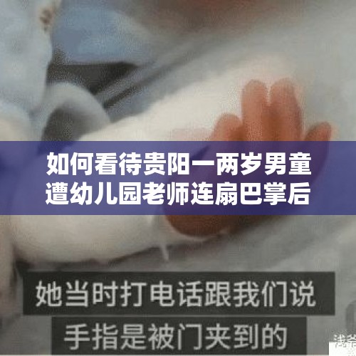 如何看待贵阳一两岁男童遭幼儿园老师连扇巴掌后头部骨折？，一次批评引发的暴力：仁寿被学生持砖砸伤的老师20天天未苏醒。现在的学生怎么了？