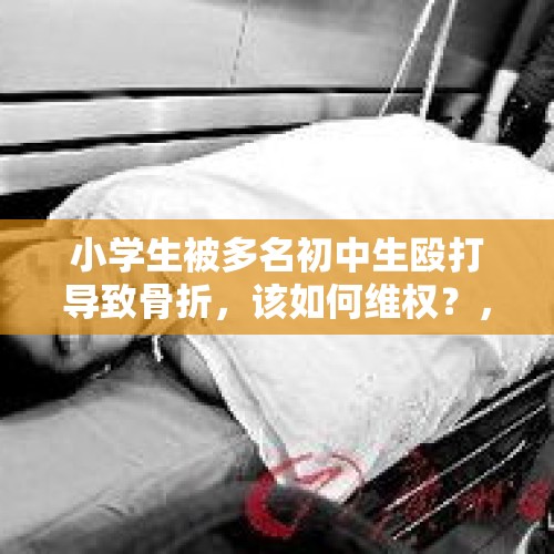 小学生被多名初中生殴打导致骨折，该如何维权？，娶了小35岁保姆后，大连退休老师被殴打多处骨折，有家难回, 你怎么看？