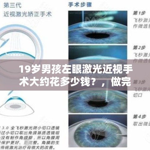 19岁男孩左眼激光近视手术大约花多少钱？，做完全飞秒激光近视手术左眼流泪感觉有异物感？