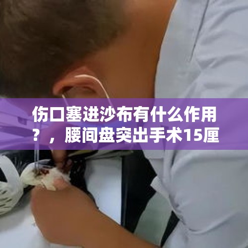 伤口塞进沙布有什么作用？，腰间盘突出手术15厘米长伤口多少天就可以去掉纱布了？