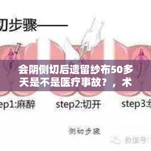 会阴侧切后遗留纱布50多天是不是医疗事故？，术后伤口涂樟脑膏行吗？