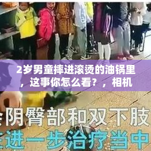 2岁男童摔进滚烫的油锅里，这事你怎么看？，相机闪光灯对一百天的宝宝眼睛有没有影响？