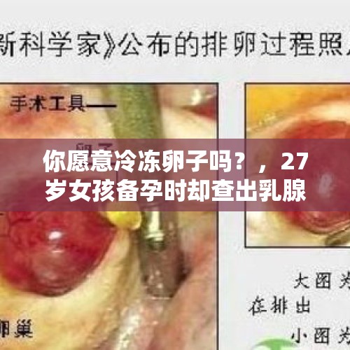 你愿意冷冻卵子吗？，27岁女孩备孕时却查出乳腺癌，想要孩子的小两口怎么办？