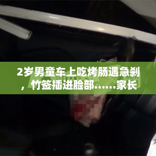 2岁男童车上吃烤肠遇急刹，竹签插进脸部……家长独自开车带娃要注意 - 今日头条