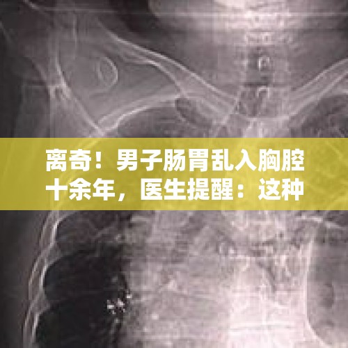 离奇！男子肠胃乱入胸腔十余年，医生提醒：这种情况一定要定期复查 - 今日头条