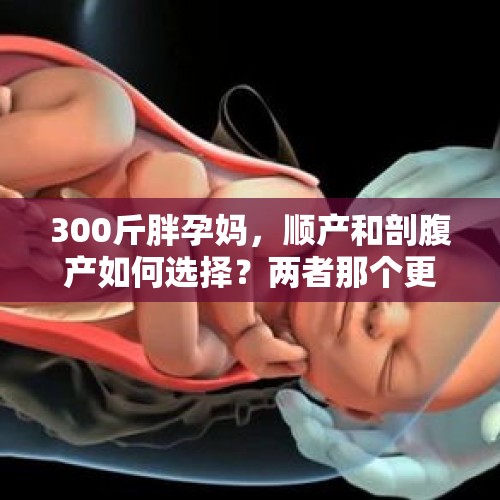 300斤胖孕妈，顺产和剖腹产如何选择？两者那个更适合胖胖孕妈？，生小孩国家给补助钱吗？