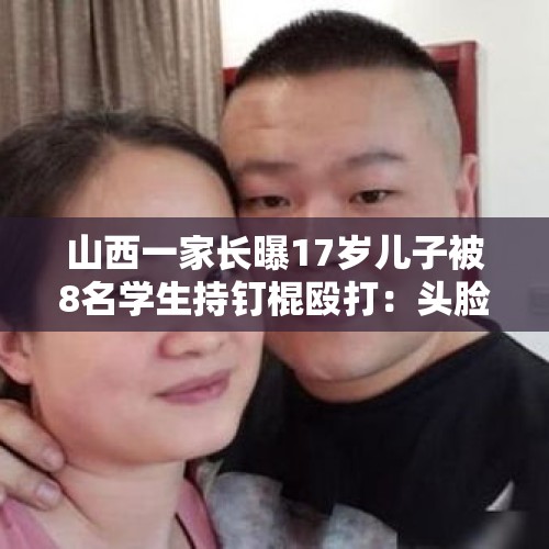 山西一家长曝17岁儿子被8名学生持钉棍殴打：头脸脖子被扎成窟窿眼！校方回应 - 今日头条